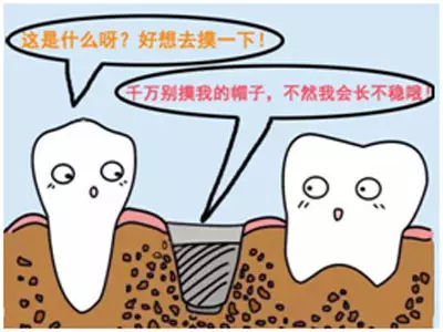 种植牙有什么风险和后遗症