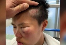一名9年级14岁华裔女孩在加拿大学校被打晕